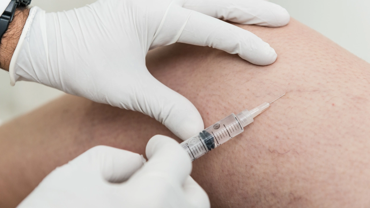 Sclerotherapy VEIN DR IN avondale gilbert surprise phoenix