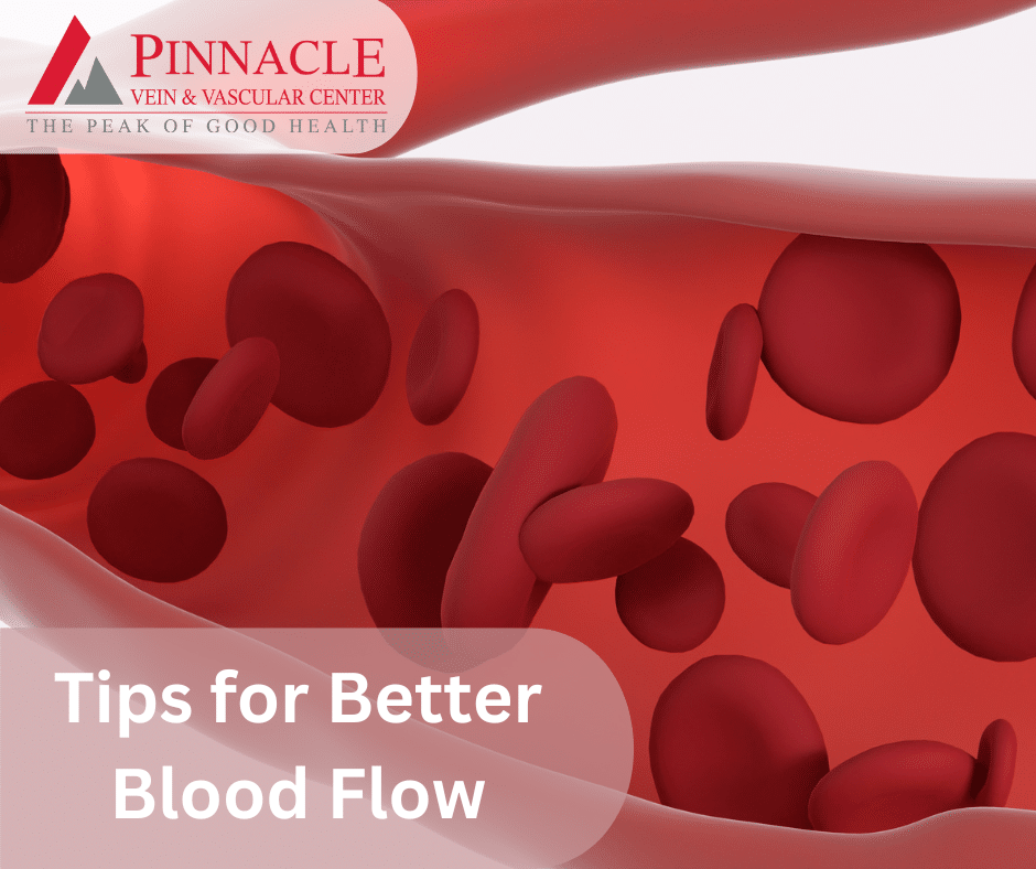 Tips for better blood flow pinnacle vein center