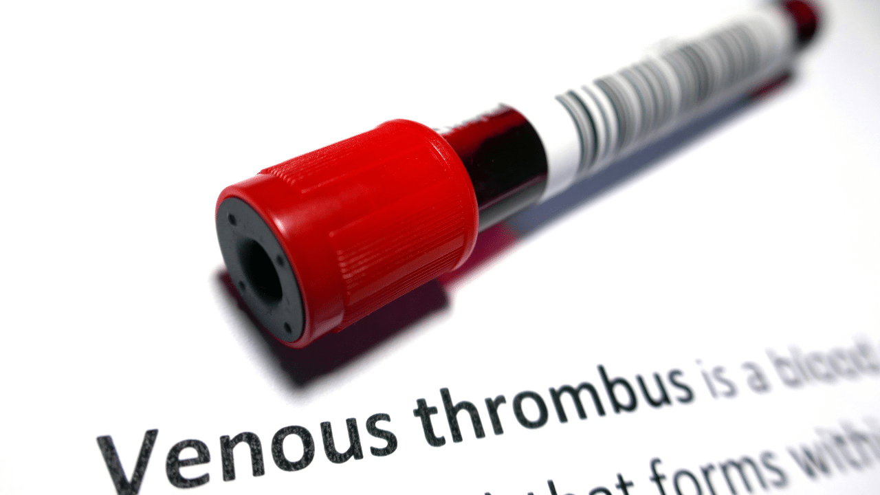 Venous Thromboembolism Risks and Prevention pinnacle vein Avondale