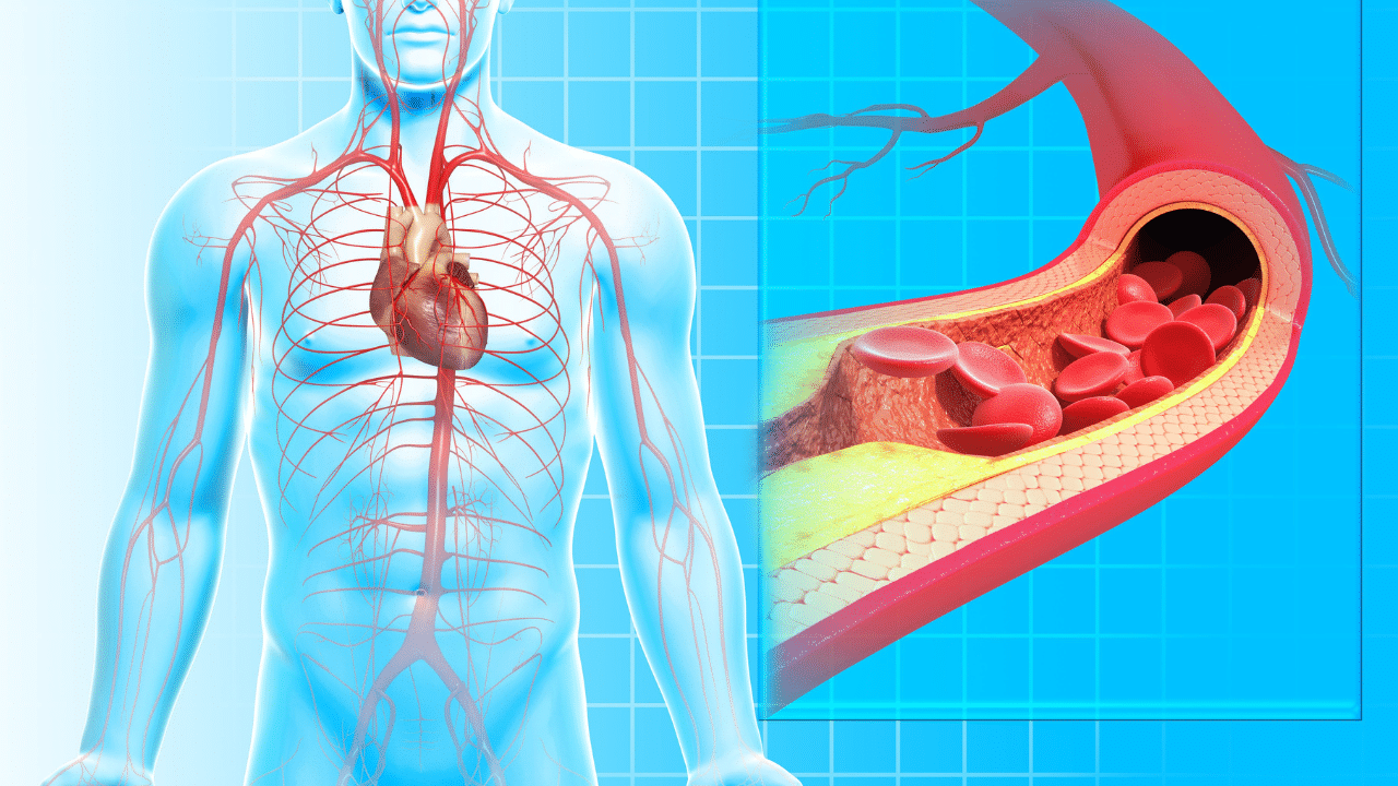 circulation issues pinnacle vein