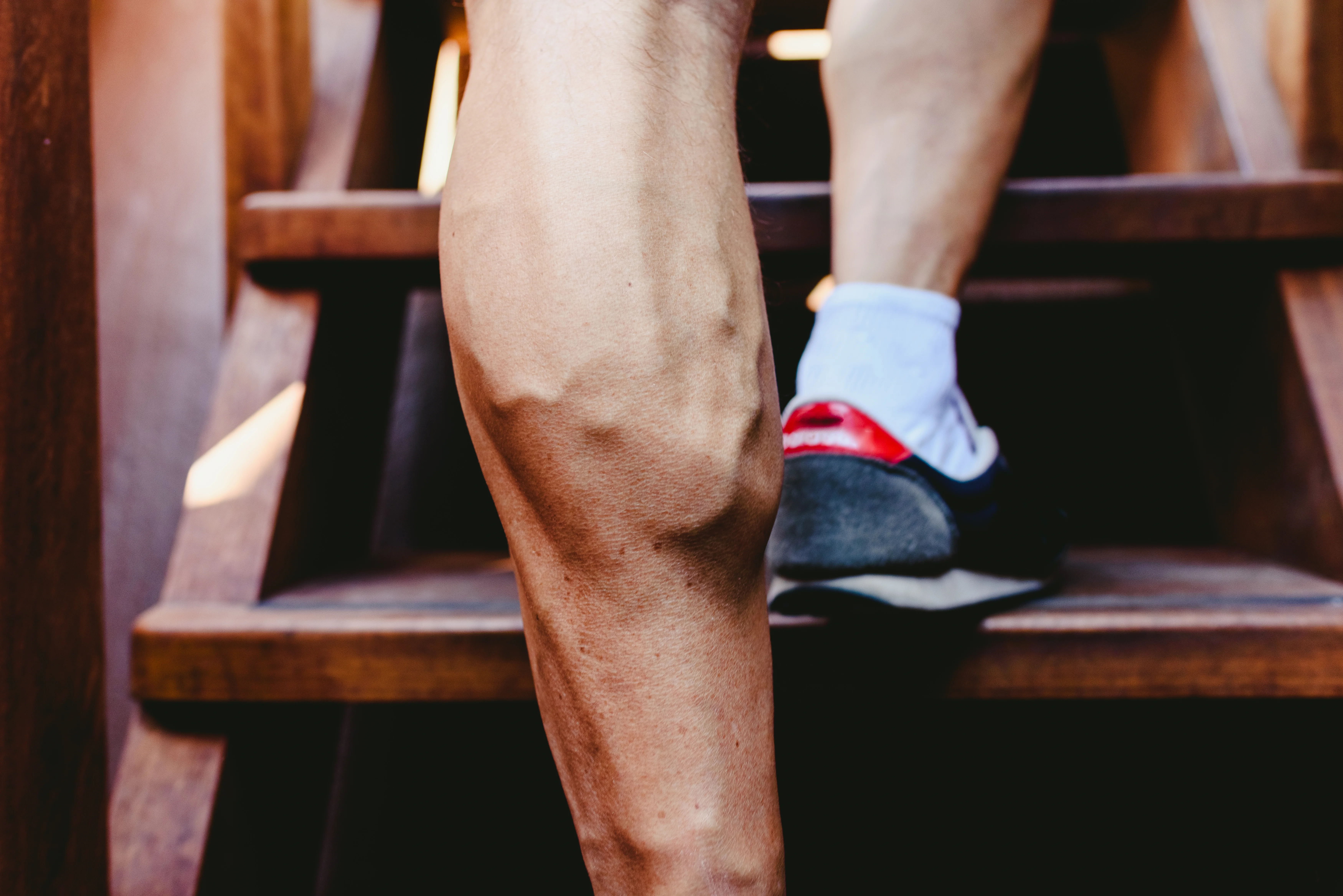 dvt-vein-and-vascular-surgeon-surprise