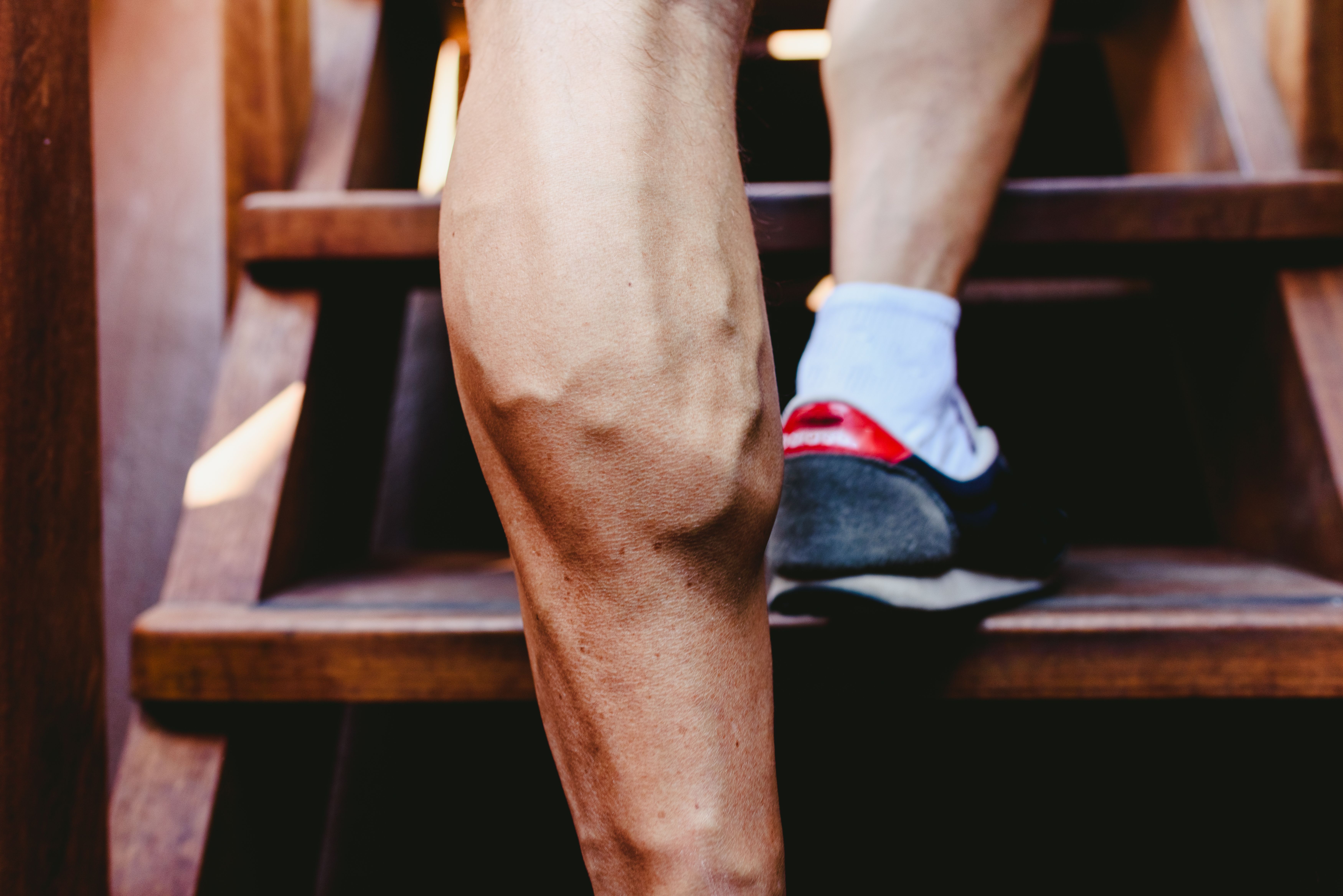 dvt-vein-and-vascular-surgeon-surprise