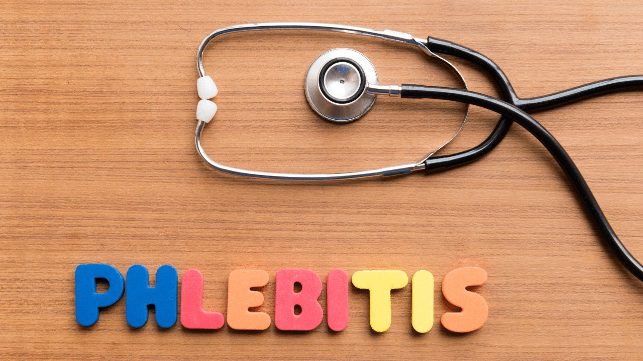 phlebitis pinnacle vein symptoms