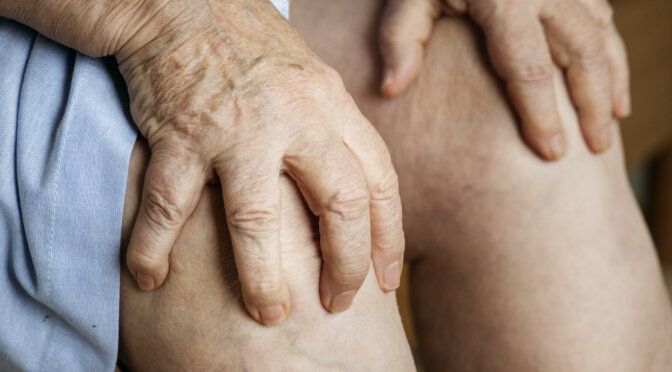 varicose vein treatment surprise az